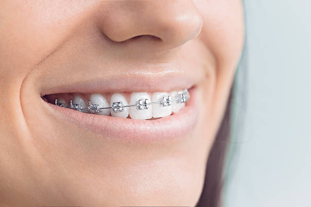 Best Dental Inlays and Onlays  in Isla Vista, CA